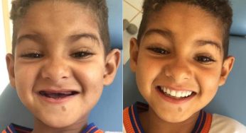 Guajeru: Dentista realiza sonho de menino de ter dentes iguais aos dos colegas