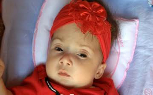 Brumado: bebê de 3 meses com hidrocefalia deve ser transferida para Conquista