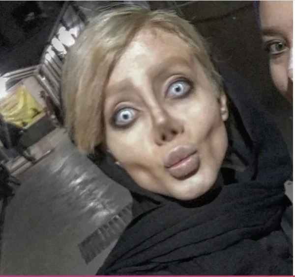 Iraniana faz mais de 50 cirurgias para ficar parecida com Angelina Jolie