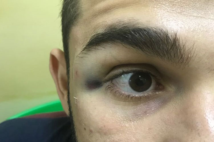 Advogado é agredido por policial militar na sede da 46ª CIPM em Livramento