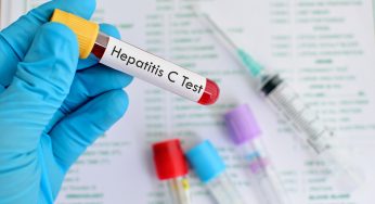 O número de infectados por Hepatite no Brasil não para de crescer