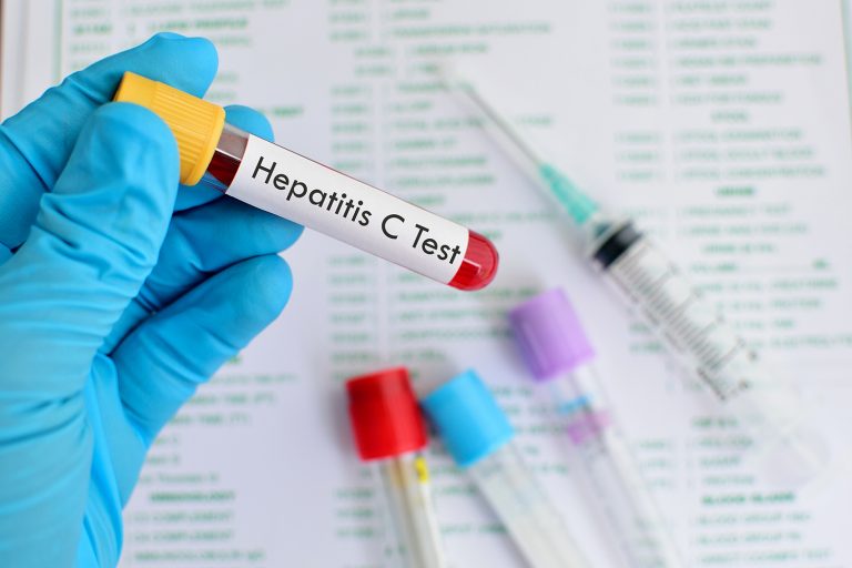 O número de infectados por Hepatite no Brasil não para de crescer