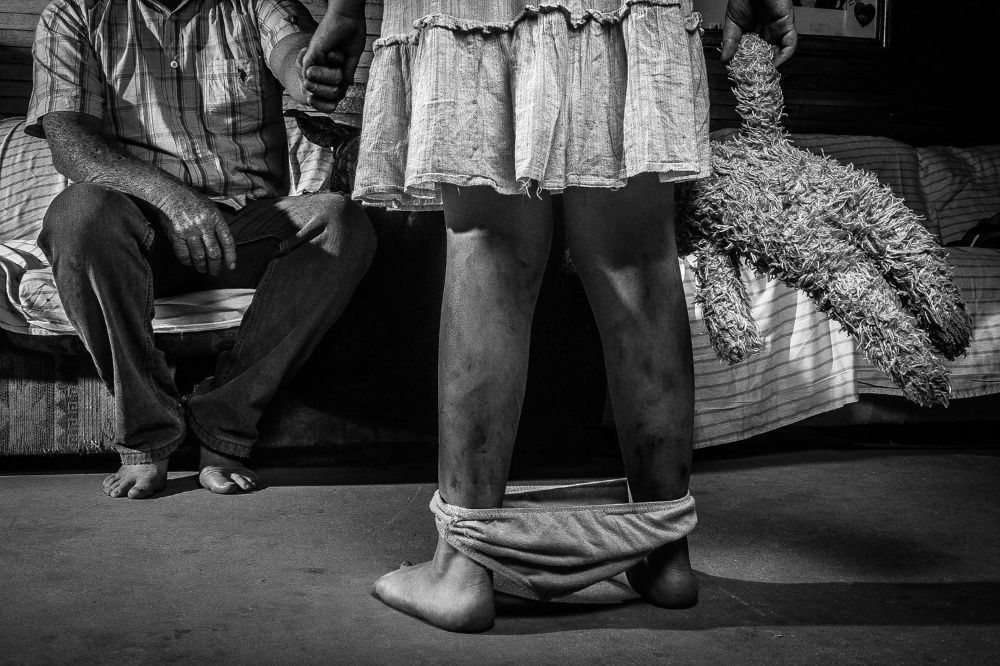 Diariamente, seis crianças ou adolescentes sofrem violência sexual na Bahia