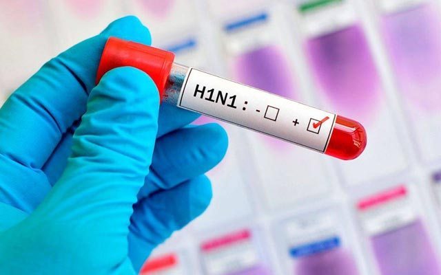 Bahia registra primeira morte por H1N1 em 2019