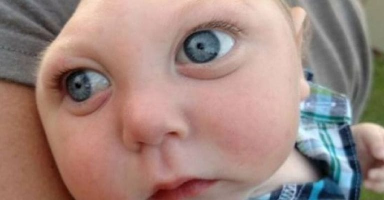 MP garante pensão a crianças nascidas com microcefalia ligada ao zika