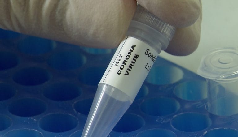 Sobe para 74 o número de mortes por covid-19 na Bahia