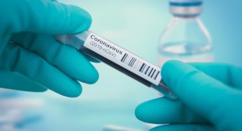 Anvisa aprova testes rápidos para covid-19 em farmácias