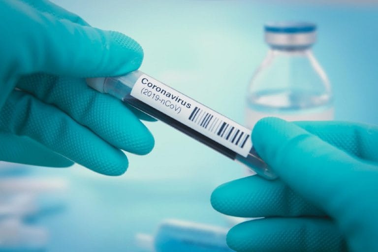 Anvisa aprova testes rápidos para covid-19 em farmácias