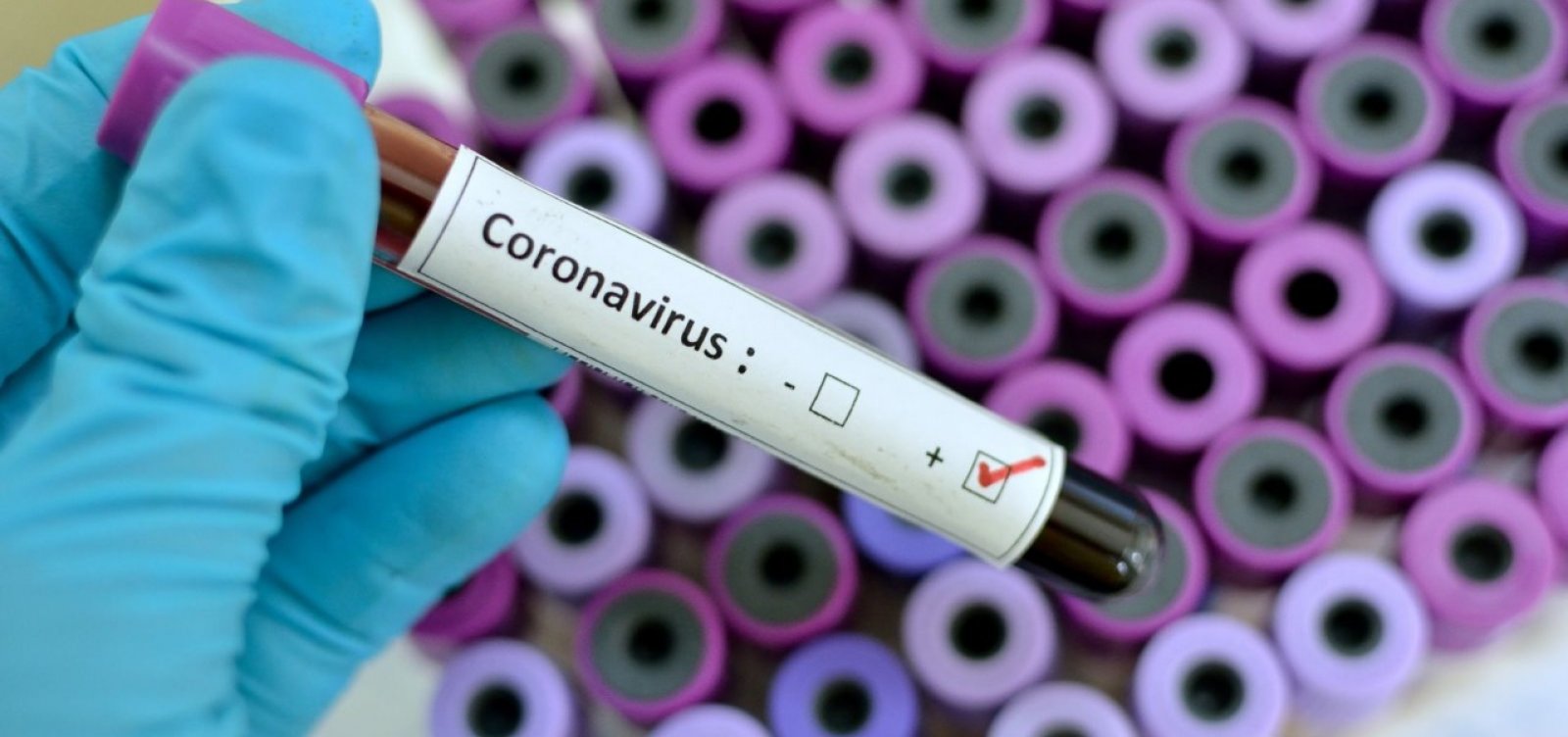 Prefeitura de Porteirinha confirma terceiro caso de coronavírus