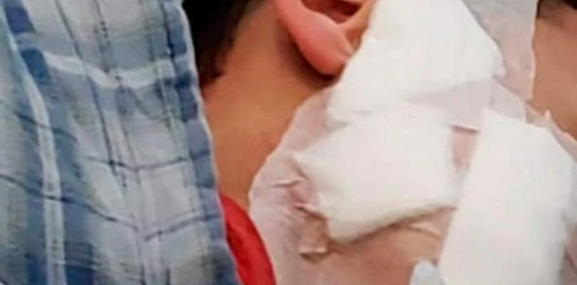 Cachorro atacou criança de nove anos em Brumado