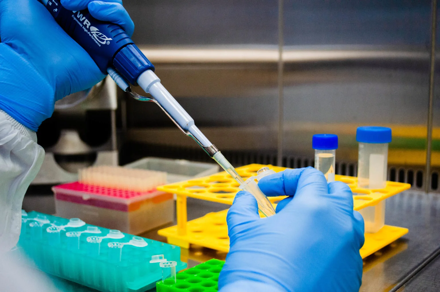 UFRJ planeja testar vacina contra covid-19 em humanos até o fim do ano