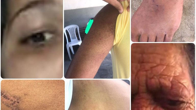 Instituto Brasil Cigano denunciou tortura contra idosa e adolescentes em Vitória da Conquista