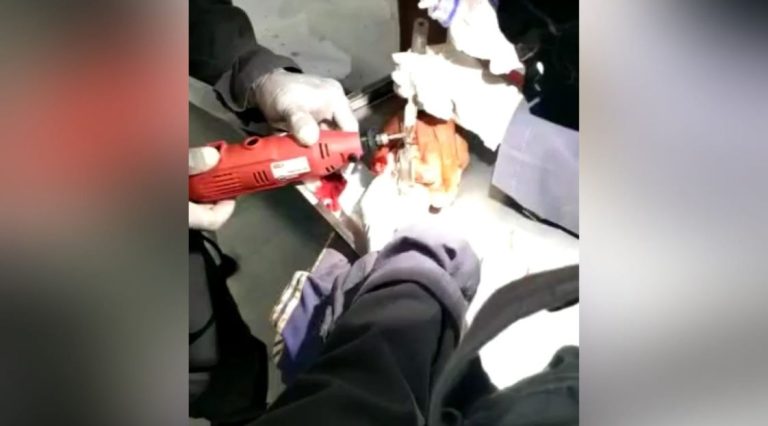 Imagem mostra bombeiros usando uma micro retífica para retirar o anal preso ao dedo