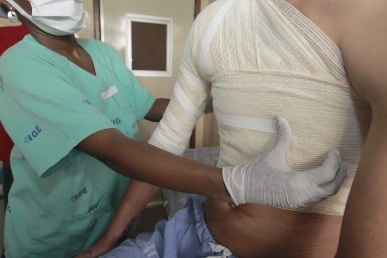 Veja como prevenir acidentes no período de São João