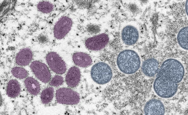Vírus monkeypox