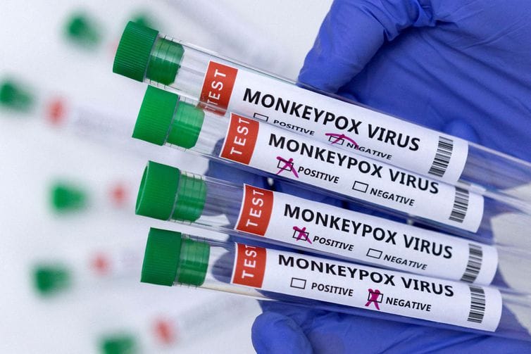 Caetité investiga caso suspeito de varíola dos macacos