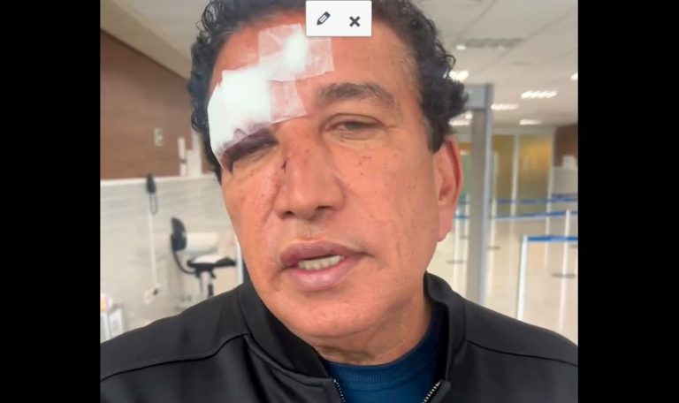 A caminho de Guanambi para acompanhar Bolsonaro, Magno Malta sofreu acidente com vidro em hotel de Vitória da Conquista