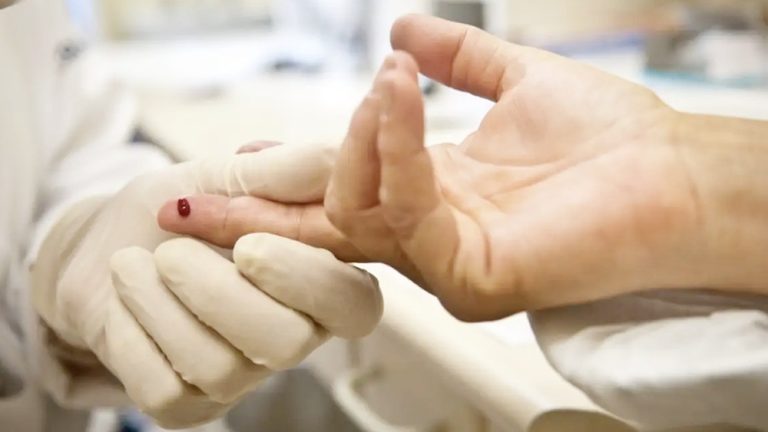 Casos de sífilis e de HIV no Brasil aumentaram entre homens jovens