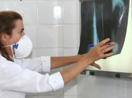 Estudo da Ufba aponta que Bolsa Família contribuiu para redução de 65% dos casos de tuberculose no Brasil