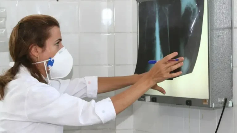 Estudo da Ufba aponta que Bolsa Família contribuiu para redução de 65% dos casos de tuberculose no Brasil