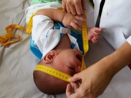 INSS pagará indenização de R$ 60 mil a crianças vítimas de zika