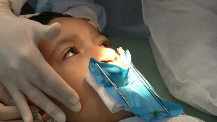 Sancionada lei que oferta cirurgia reconstrutiva de lábio leporino no SUS