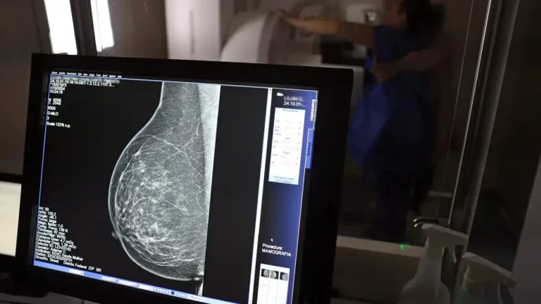 Câncer de mama uma em cada três pacientes tem menos de 50 anos