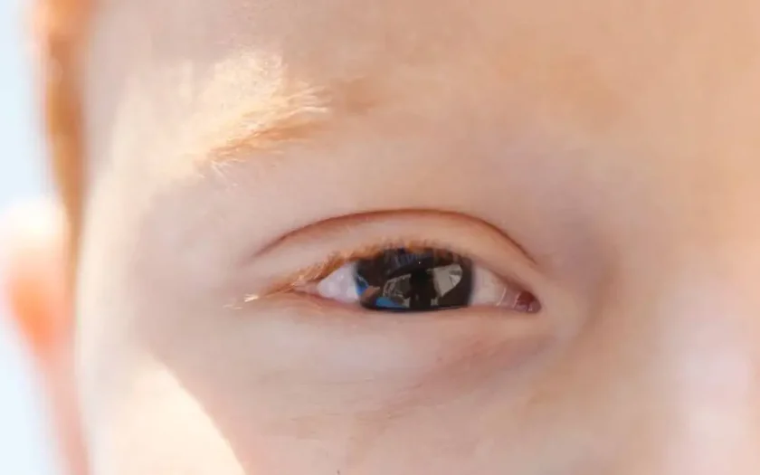 Erros de refração são principal causa de deficiência visual infantil
