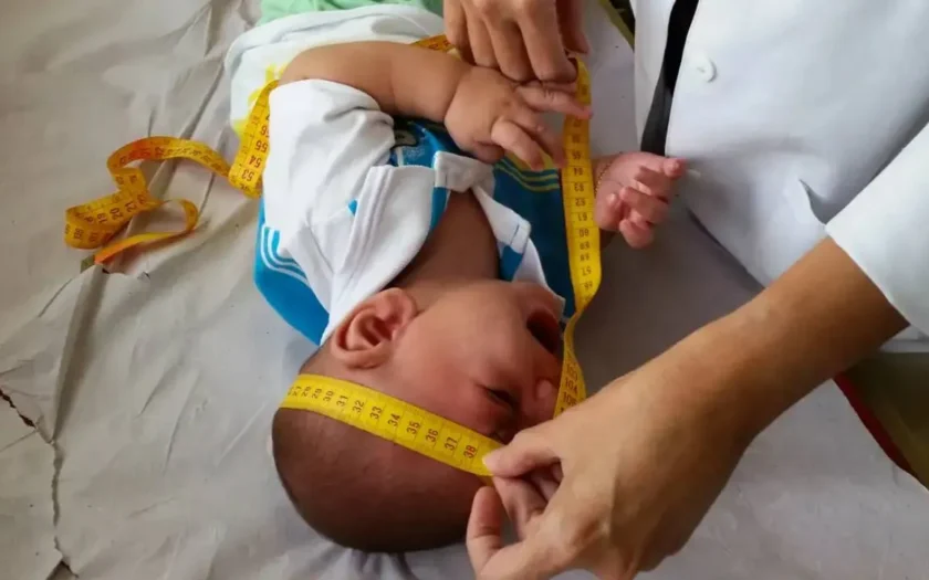 Famílias de crianças afetadas pelo Zika vírus começam a receber indenização