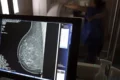 Ministério da Saúde passa a recomendar mamografia a partir dos 40 anos