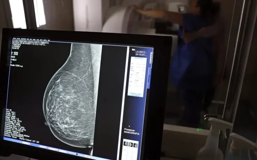 Ministério da Saúde passa a recomendar mamografia a partir dos 40 anos